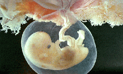 Федор Углов: «Аборт надо рассматривать как детоубийство»