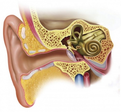 Российские врачи научились восстанавливать слух и лечить болезнь Меньера