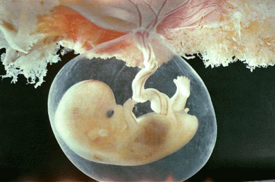 Федор Углов: «Аборт надо рассматривать как детоубийство»